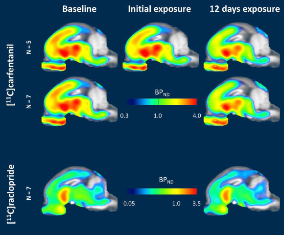 Brain neurotransmitter heat map Foody Body bioinformatics